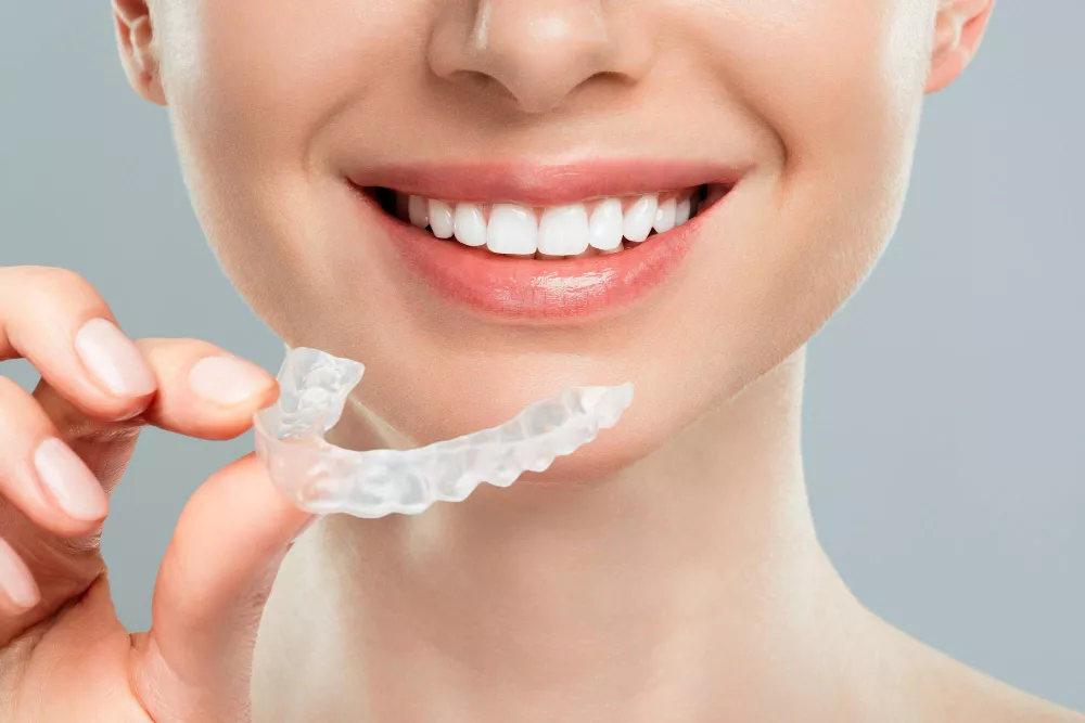 Aligners